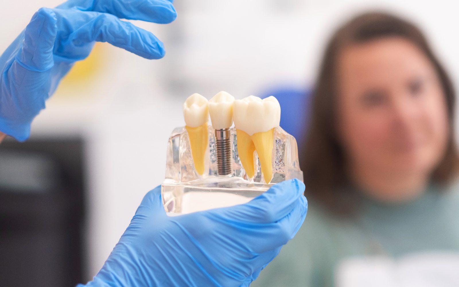 Gloved dentist holding a clear dental model showing a titanium implant post between two natural teeth roots