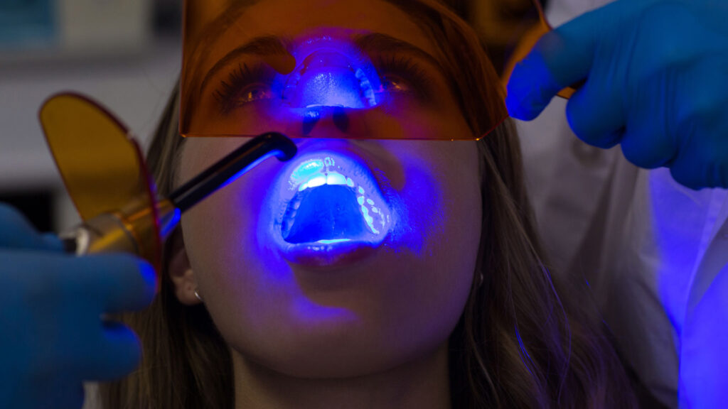 lady getting her teeth fillings